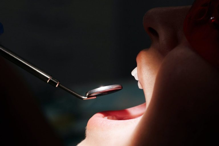 Boca abierta de un paciente durante un examen dental con un instrumento en primer plano.
